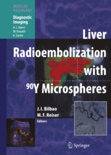 Liver Radioembolization with 90Y Microspheres