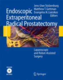 Endoscopic Extraperitoneal Radical Prostatectomy : Laparoscopic and Robot-Assisted Surgery