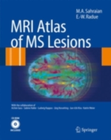 MRI Atlas of MS Lesions