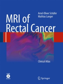MRI of Rectal Cancer : Clinical Atlas, Mixed media product Book MRI of Rectal Cancer : Clinical Atlas, Mixed media product Book