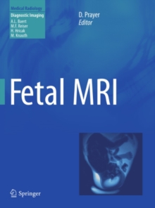 Fetal MRI