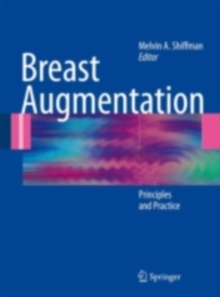 Breast Augmentation : Principles and Practice