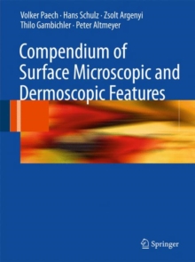 Compendium of Surface Microscopic and Dermoscopic Features, Hardback Book Compendium of Surface Microscopic and Dermoscopic Features, Hardback Book