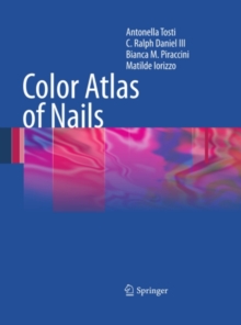 Color Atlas of Nails