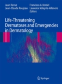 Life-Threatening Dermatoses and Emergencies in Dermatology