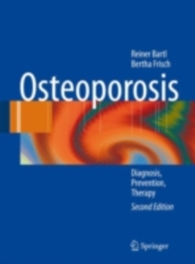 Osteoporosis : Diagnosis, Prevention, Therapy