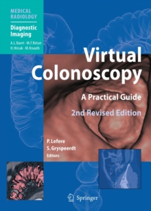 Virtual Colonoscopy : A Practical Guide