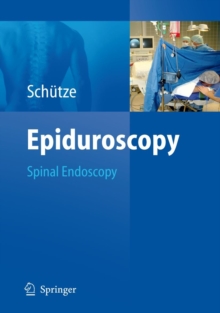 Epiduroscopy : Spinal Endoscopy