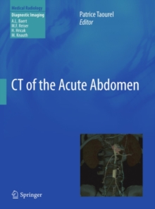 CT of the Acute Abdomen