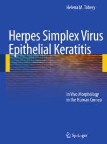 Herpes Simplex Virus Epithelial Keratitis : In Vivo Morphology in the Human Cornea