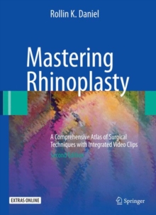 Mastering Rhinoplasty : A Comprehensive Atlas of Surgical Techniques with Integrated Video Clips, Hardback Book Mastering Rhinoplasty : A Comprehensive Atlas of Surgical Techniques with Integrated Video Clips, Hardback Book