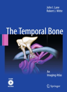 Temporal Bone : An Imaging Atlas