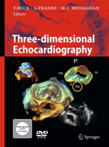 Three-dimensional Echocardiography