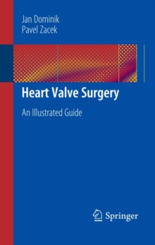 Heart Valve Surgery : An Illustrated Guide