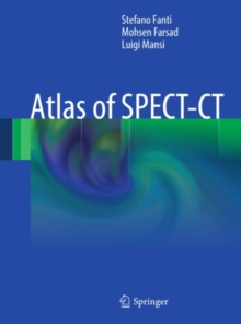 Atlas of SPECT-CT