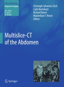 Multislice-CT of the Abdomen