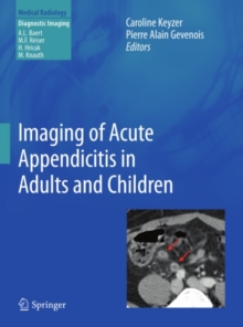 Imaging of Acute Appendicitis in Adults and Children