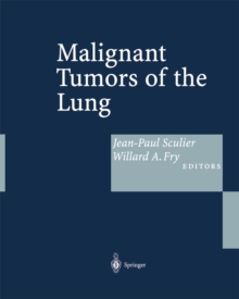 Malignant Tumors of the Lung : Evidence-based Management