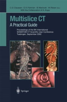 Multislice CT : A Practical Guide Proceedings of the 6th International SOMATOM CT Scientific User Conference Tuebingen, September 2002