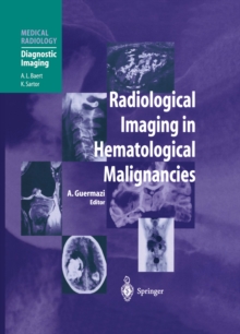 Radiological Imaging in Hematological Malignancies