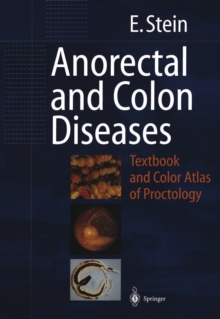 Anorectal and Colon Diseases : Textbook and Color Atlas of Proctology