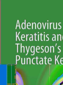 Adenovirus Epithelial Keratitis and Thygeson's Superficial Punctate Keratitis : In Vivo Morphology in the Human Cornea