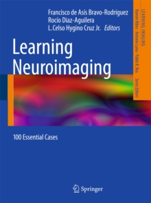 Learning Neuroimaging : 100 Essential Cases, Paperback Book Learning Neuroimaging : 100 Essential Cases, Paperback Book