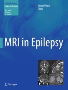 MRI in Epilepsy