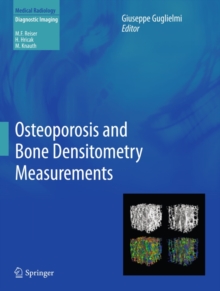 Osteoporosis and Bone Densitometry Measurements