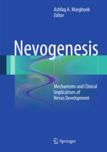 Nevogenesis : Mechanisms and Clinical Implications of Nevus Development