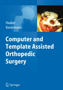 Computer and Template Assisted Orthopedic Surgery