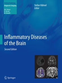 Inflammatory Diseases of the Brain, Hardback Book Inflammatory Diseases of the Brain, Hardback Book