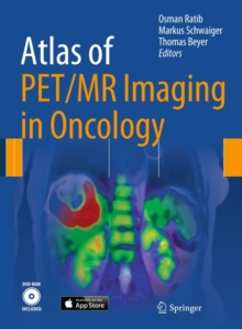 Atlas of PET/MR Imaging in Oncology