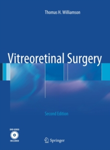 Vitreoretinal Surgery