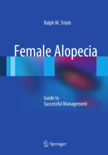 Female Alopecia : Guide to Successful Management