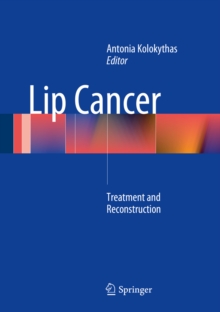 Lip Cancer : Treatment and Reconstruction