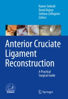 Anterior Cruciate Ligament Reconstruction : A Practical Surgical Guide