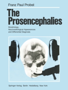 The Prosencephalies : Morphology, Neuroradiological Appearances and Differential Diagnosis