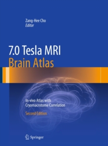 7.0 Tesla MRI Brain Atlas : In-vivo Atlas with Cryomacrotome Correlation