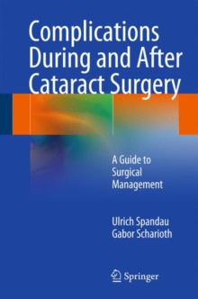 Complications During and After Cataract Surgery : A Guide to Surgical Management