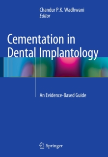 Cementation in Dental Implantology : An Evidence-Based Guide