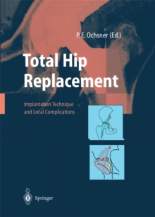 Total Hip Replacement : Implantation Technique and Local Complications