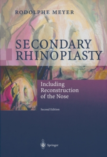 Secondary Rhinoplasty : Including Reconstruction of the Nose