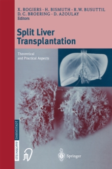 Split liver transplantation : Theoretical and practical aspects