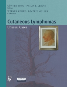 Cutaneous Lymphomas : Unusual Cases