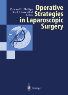 Operative Strategies in Laparoscopic Surgery