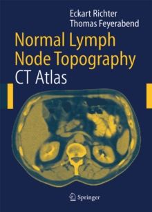 Normal Lymph Node Topography : CT Atlas