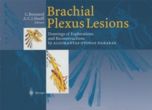 Brachial Plexus Lesions : Drawings of Explorations and Reconstructions by Algimantas Otonas Narakas