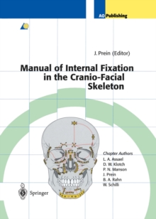 Manual of Internal Fixation in the Cranio-Facial Skeleton : Techniques Recommended by the AO/ASIF Maxillofacial Group