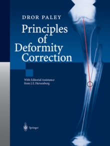 Principles of Deformity Correction